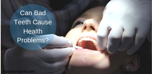 Can Bad Teeth Cause Health Problems_